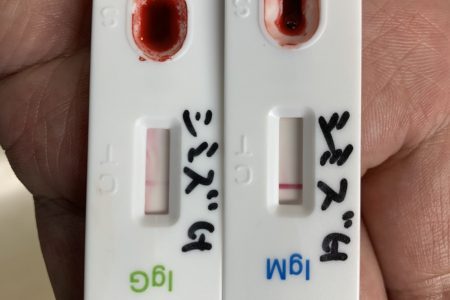 コロナ抗体検査