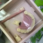 バレンタインデー🦷🍫